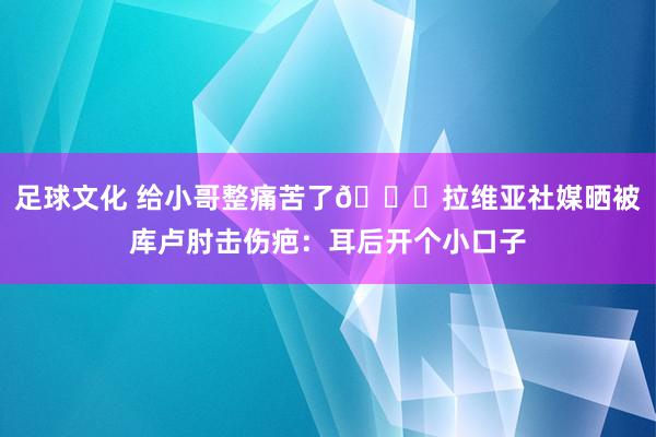 足球文化 给小哥整痛苦了😅拉维亚社媒晒被库卢肘击伤疤：耳后开个小口子